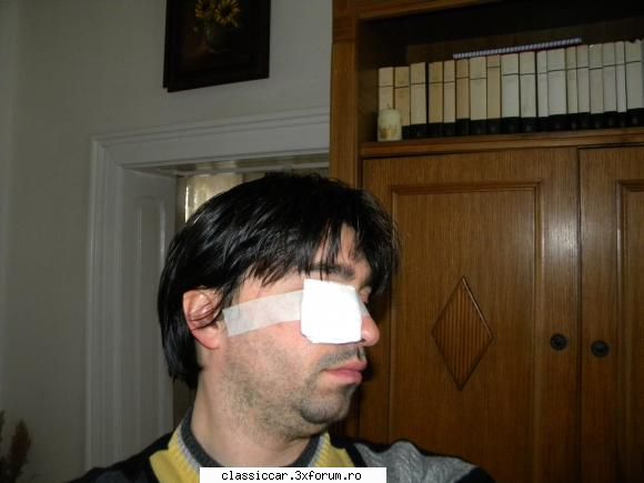 Aro M 461C - din pacate va urma o scurta pauza. Nu am purtat - Reconditionari si Restaurari